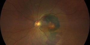 上海眼科院长：眼前黑影、视物变形、视力下降，这些眼睛发出的信号千万别忽视！