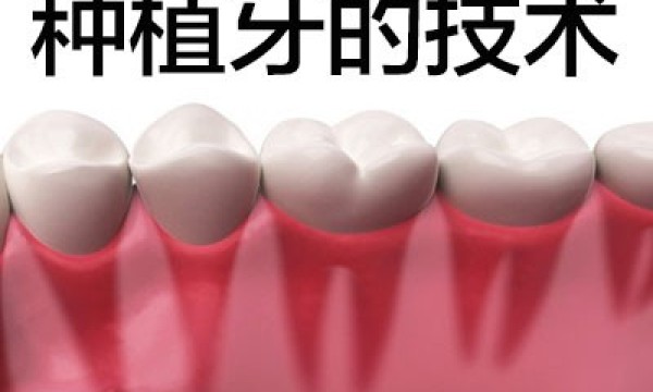种植牙的条件？ 天津数字化种植牙和传统种植牙区别?